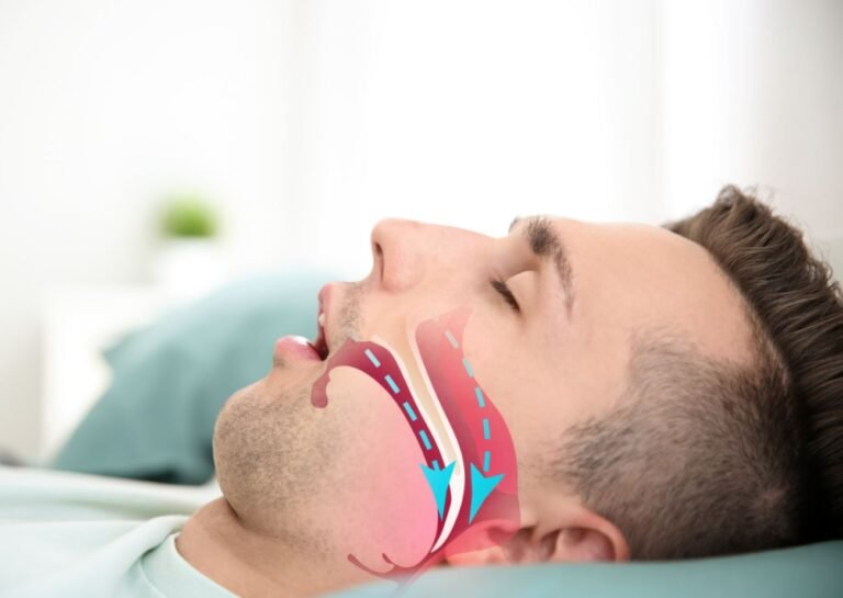 Joe Rogan’s Sleep Apnea Mouth Piece Solution for Better Rest