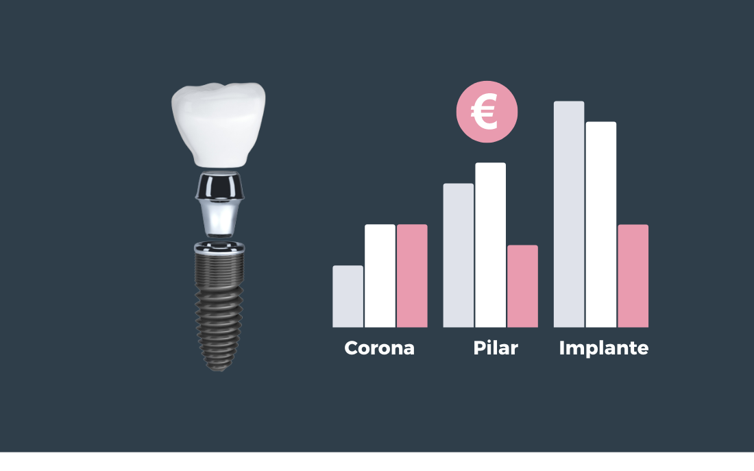 comparacion de precios de implantes dentales