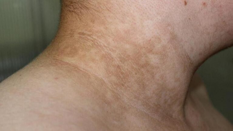 Dr. Gundry Polyphenol Dark Spot Diminisher: Effective Skincare Solution