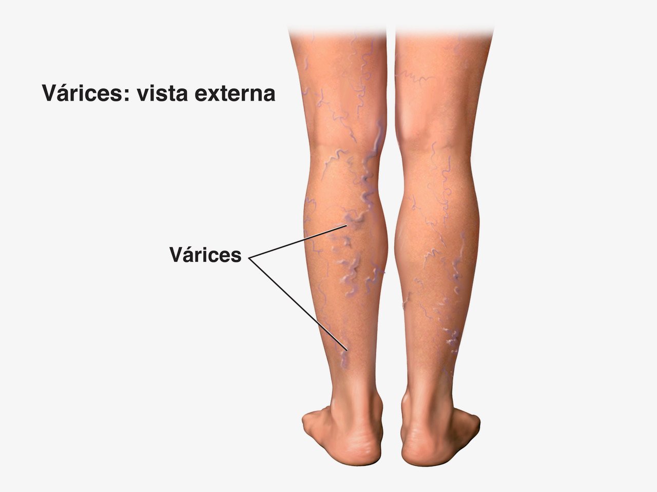 piernas sin venas varicosas piel saludable