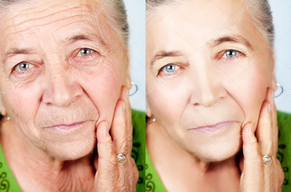 rostro con piel suave y sin arrugas 1