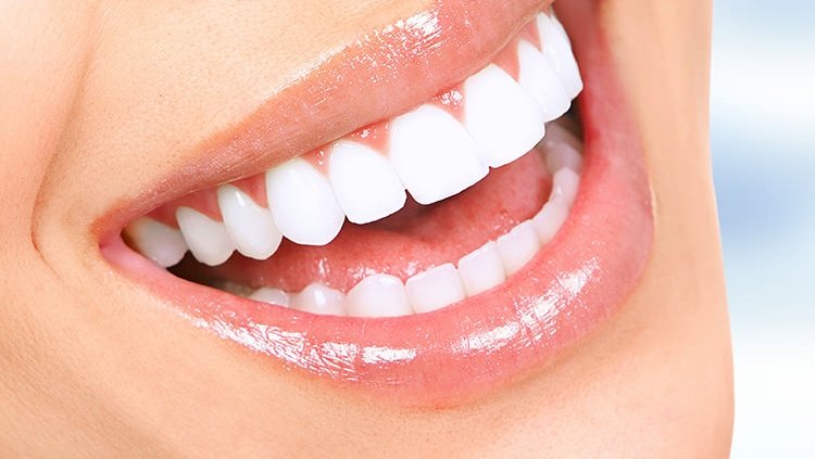 Do Pop On Veneers Look Real? Exploring Their Authenticity
